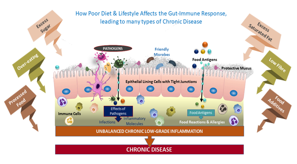 How poor diet and lifestyle affects the gut-immune response